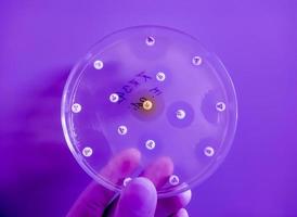 Antimicrobial susceptibility testing in petri dish. Antibiotic resistance of bacteria photo