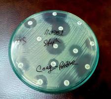 Antimicrobial susceptibility testing in petri dish. Antibiotic resistance of bacteria photo