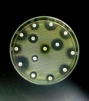 Antimicrobial susceptibility testing in petri dish. Antibiotic resistance of bacteria photo