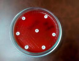 Antimicrobial susceptibility testing in petri dish. Antibiotic resistance of bacteria photo