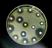 Antimicrobial susceptibility testing in petri dish. Antibiotic resistance of bacteria photo