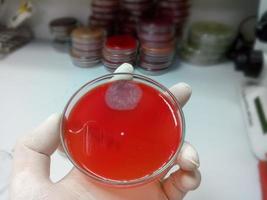 Fungus growth on blood agar medium, Sputum culture photo