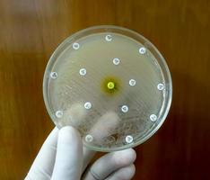 Pruebas de susceptibilidad a los antimicrobianos en placa de Petri. resistencia a los antibióticos de las bacterias foto