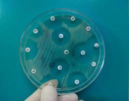 Antimicrobial susceptibility testing in petri dish. Antibiotic resistance of bacteria photo