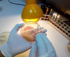 Scientist or microbiologist working to ready perti dish which is then use to diagnosis for antibiotic resistance of microorganism photo