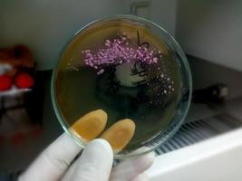 colonia de bacterias en placa de medio de cultivo. cultivo de heces, E. coli foto