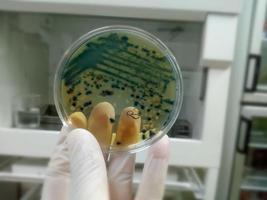 Gloved Hand of a Technician or scientist holding petri dish in the background of a microbiology laboratory. Bacterial Culture Media. Microbiologist. Bacteria. photo