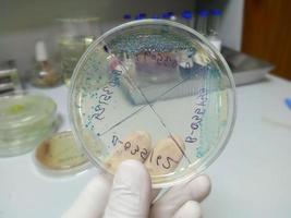 vista de cerca de los medios de cultivo de orina. placa de Petri de enterobacter spp. mano enguantada sosteniendo medios de cultivo en laboratorio. foto