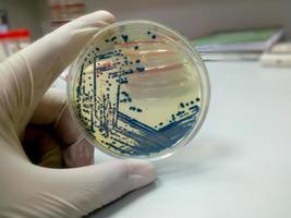 Mano enguantada de un técnico o científico sosteniendo una placa de Petri en el fondo de un laboratorio de microbiología. medios de cultivo bacteriano. microbiólogo. bacterias. foto
