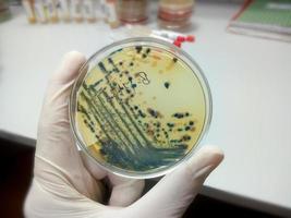 Mano enguantada de un técnico o científico sosteniendo una placa de Petri en el fondo de un laboratorio de microbiología. medios de cultivo bacteriano. microbiólogo. bacterias. foto