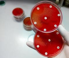 Antimicrobial susceptibility testing in petri dish. Antibiotic resistance of bacteria photo