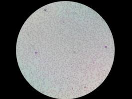 Microscopic view of Hematology slide . close view. photo