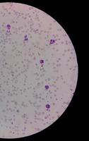 Microscopic view of stained slide of Hematology in laboratory. close up. total blood count. photo