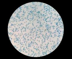Close microscopic view of abnormal reticulocyte count in hematology department, methylene blue staining