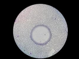 Microscopic view of stained slide of Hematology in laboratory. close up. total blood count. photo