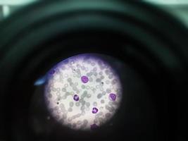 Vista microscópica del portaobjetos teñido de hematología en laboratorio. de cerca. recuento sanguíneo total. foto