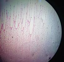 Vista microscópica del portaobjetos teñido de hematología en laboratorio. de cerca. recuento sanguíneo total. foto