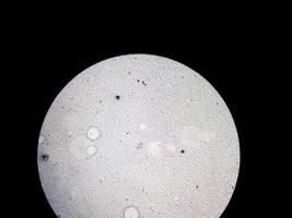 Vista microscópica del portaobjetos teñido de hematología en laboratorio. de cerca. recuento sanguíneo total. foto