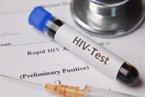 HIV blood test tube and prescription on table photo