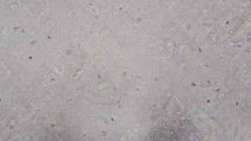 esperma humano vivo, movimento dos espermatozóides, sob o microscópio video