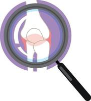 Elbow joint with magnifying glass vector