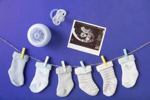 baby s sock hanging clothesline with milk bottle pacifier ultrasound picture blue backdrop