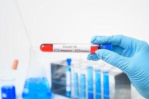 laboratory assistant hand is holding blood test infected Covid-19 photo