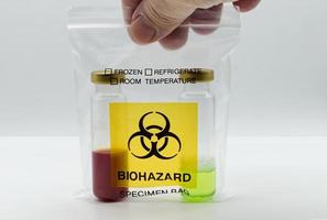 Man holding a Biohazard Specimen Bag in his hand with two test tubes inside. photo