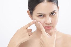 portrait of young beautiful woman is checking her skin and popping pimple over white background studio photo