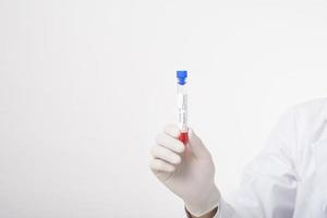 Doctor is holding infected  covid-19  blood test  on white Background photo
