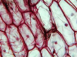 Onion epidermus micrograph photo