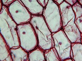 Onion epidermus micrograph photo