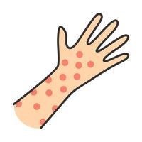 Skin rash, hives color icon. Food, medication, insect bites allergy reaction. Urticaria, eczema, psoriasis. Itchy spots, irritation on hand. Chickenpox, measles symptom. Isolated vector illustration