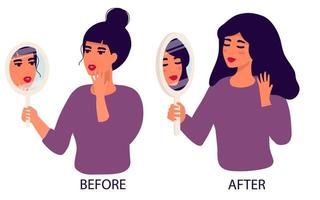 bad skin face of girl. troubled by bad condition. Beautiful Woman with Wrinkles on Face. Treatment of wrinkles. Face without Skin Problems. Clean Face Smile. Before after. flat cartoon style. Vector. vector