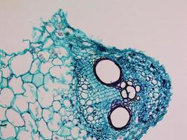 Cucurbita stem micrograph photo