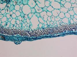 Cucurbita stem micrograph photo