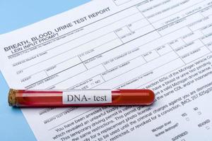 DNA molecule forming inside the vial in for blood analysis.3D rendering, conceptual images. photo