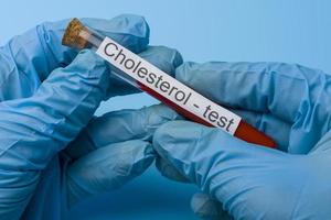 Hand Holding a Cholesterol Test in a test tube on a Blue Background.
