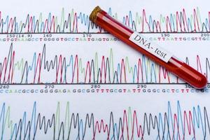 DNA molecule forming inside the vial in for blood analysis.3D rendering, conceptual images. photo