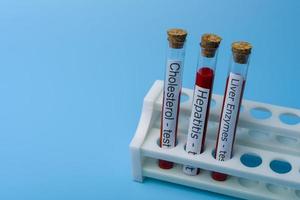 Cholesterol test Hepatitis Test and liver Enzyme Test, in Vitro. photo