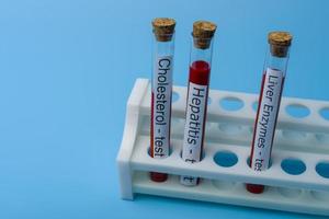 Cholesterol test Hepatitis Test and liver Enzyme Test, in Vitro. photo