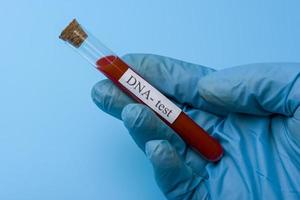 Hand Holding a DNA Test in a test tube on a Blue Background.