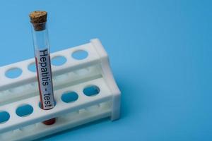 Hepatitis test, Blood in the test Tube. photo