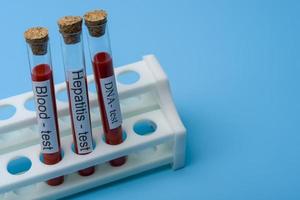 Blood test Hepatitis Test and DNA Test in Vitro. photo