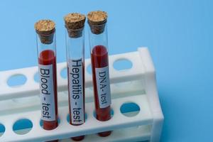 Blood test Hepatitis Test and DNA Test in Vitro. photo