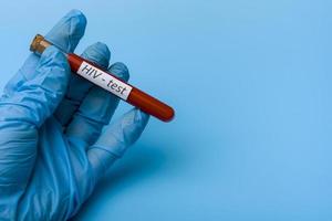 Hand Holding an HIV Test in a test tube on a Blue Background. photo