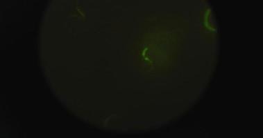 Handheld shot of highlighted green microorganisms worms under the microscope video