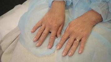 ossos das mãos de uma velha antes de uma cirurgia de operação de rejuvenescimento da pele video