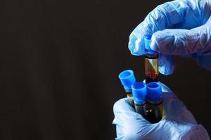 hand in blue medical gloves holding blood test tube with copy space photo