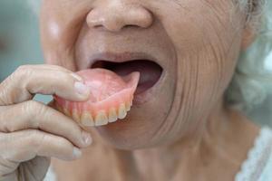 Paciente asiático mayor o anciano sosteniendo para usar dentadura en la sala del hospital de enfermería, concepto médico fuerte y saludable foto